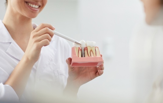 Dentist explaining the benefits of dental implants using a smile model